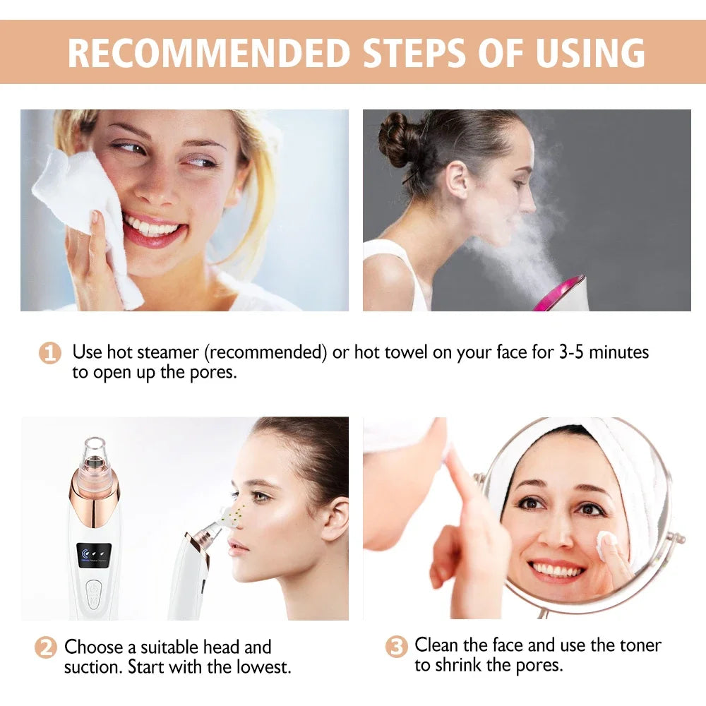 Electric Blackhead Remover Vacuum – 5 Suction Heads & 3 Power Levels