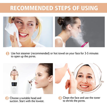 Electric Blackhead Remover Vacuum – 5 Suction Heads & 3 Power Levels