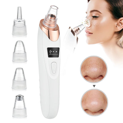 Electric Blackhead Remover Vacuum – 5 Suction Heads & 3 Power Levels