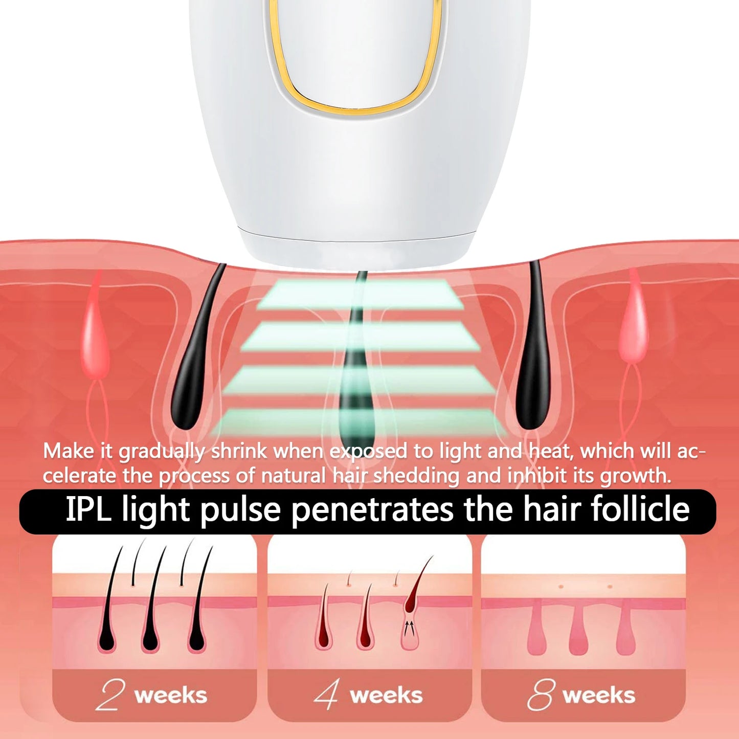 IPL Laser Hair Removal Device – 500,000 Flashes, Permanent Results
