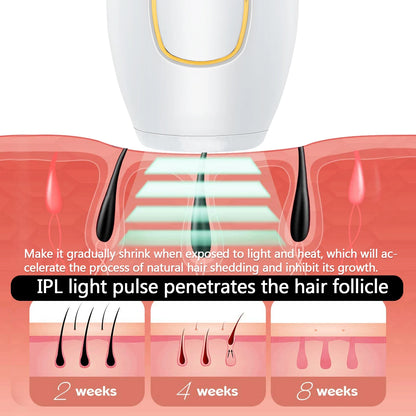 IPL Laser Hair Removal Device – 500,000 Flashes, Permanent Results