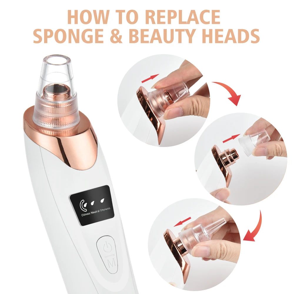 Electric Blackhead Remover Vacuum – 5 Suction Heads & 3 Power Levels