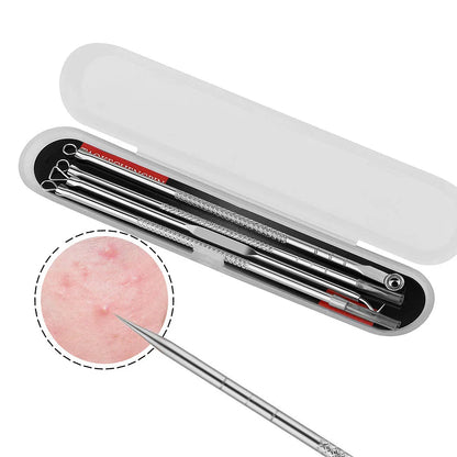 Electric Blackhead Remover Vacuum – 5 Suction Heads & 3 Power Levels