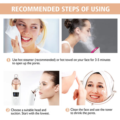 Electric Blackhead Remover Vacuum – 5 Suction Heads & 3 Power Levels