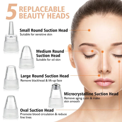 Electric Blackhead Remover Vacuum – 5 Suction Heads & 3 Power Levels