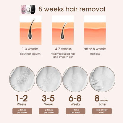 IPL Laser Hair Removal Device – 500,000 Flashes, Permanent Results