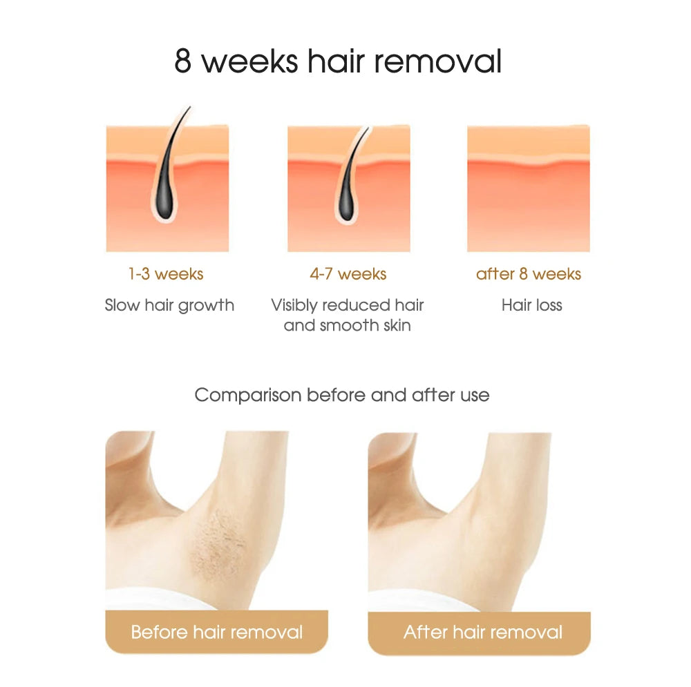 IPL Laser Hair Removal Device – 500,000 Flashes, Permanent Results